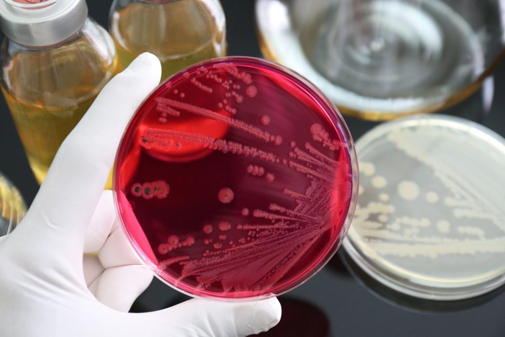 £19.2m food safety project to track foodborne pathogens