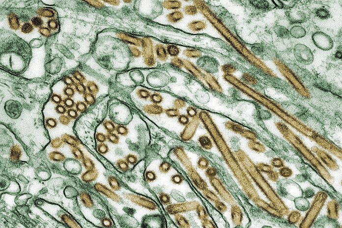 Highly Pathogenic Avian Influenza A (H5N1) Virus Infection reported in a person in the US