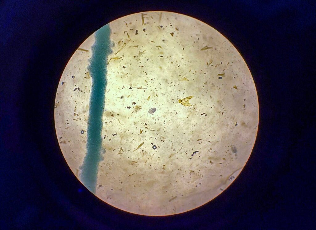 It takes practice to differentiate a parasite from detritus in a sample while under the microscope, which producers received during the Ontario Sheep Farmer Fecal Egg Count workshop in Lindsay on June 18, 2025. Photo by Diana Martin