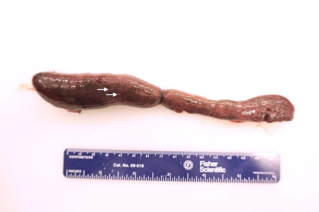 The spleen of a beaver lays on a white surface above a blue ruler for scale.