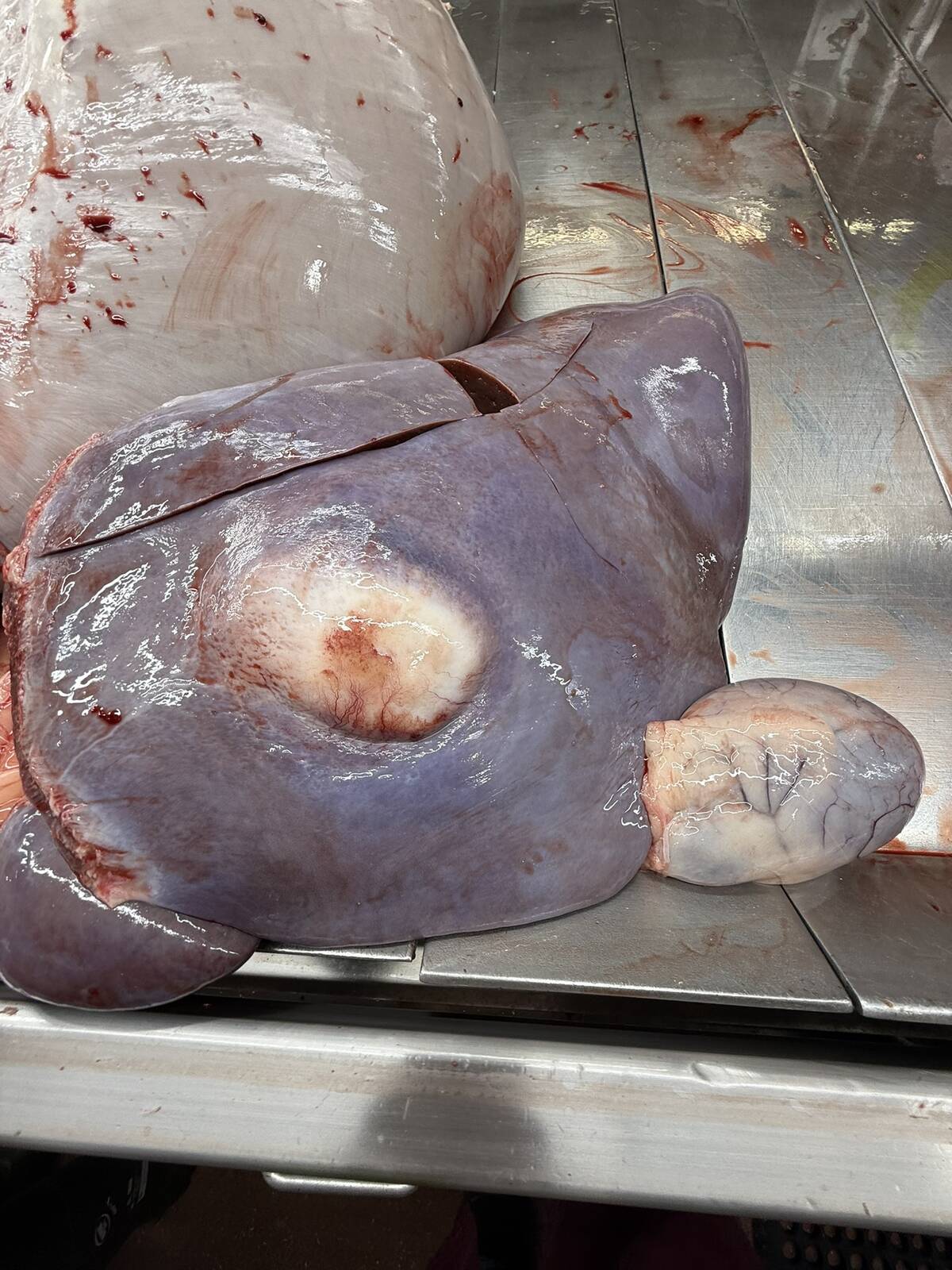 A cow liver sits on a stainless steel table with two whitish areas on it.