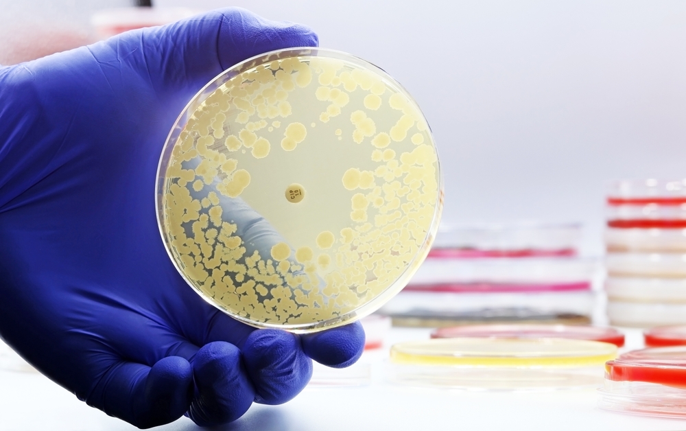 Foodborne antimicrobial resistance threat persists across Europe